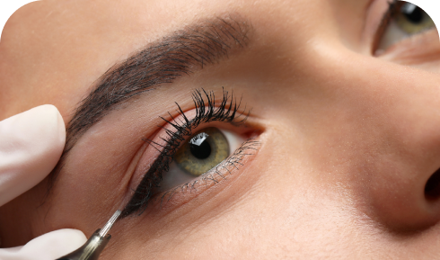treatments.items.olhos.title