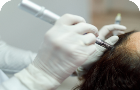 treatments.items.tratamentos_capilares.title